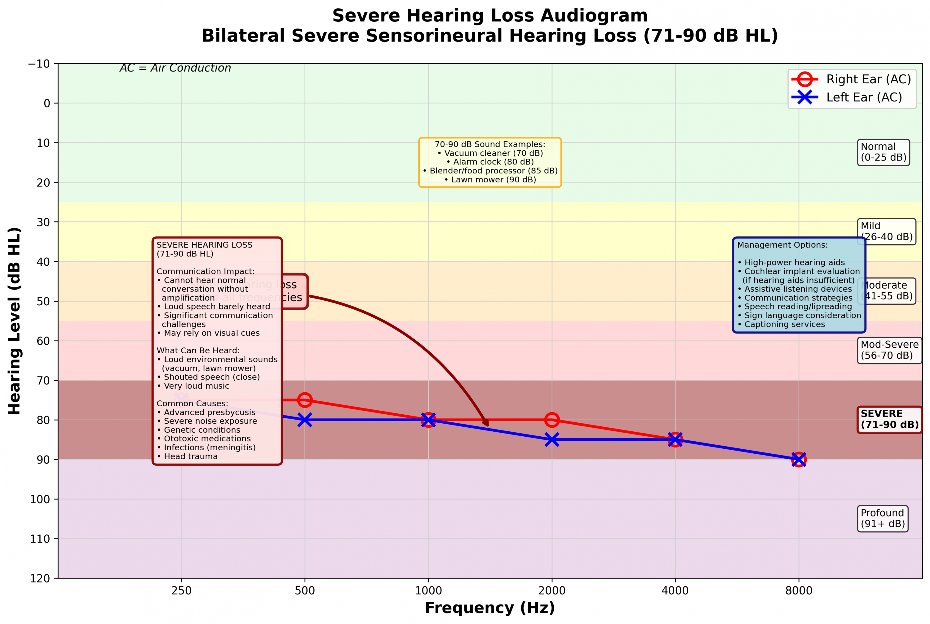 Severe hearing loss audiogram