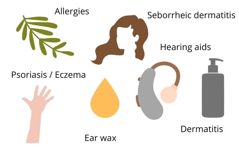 Warning signs your ears can give you about your health - from itchiness to  wax - Mirror Online