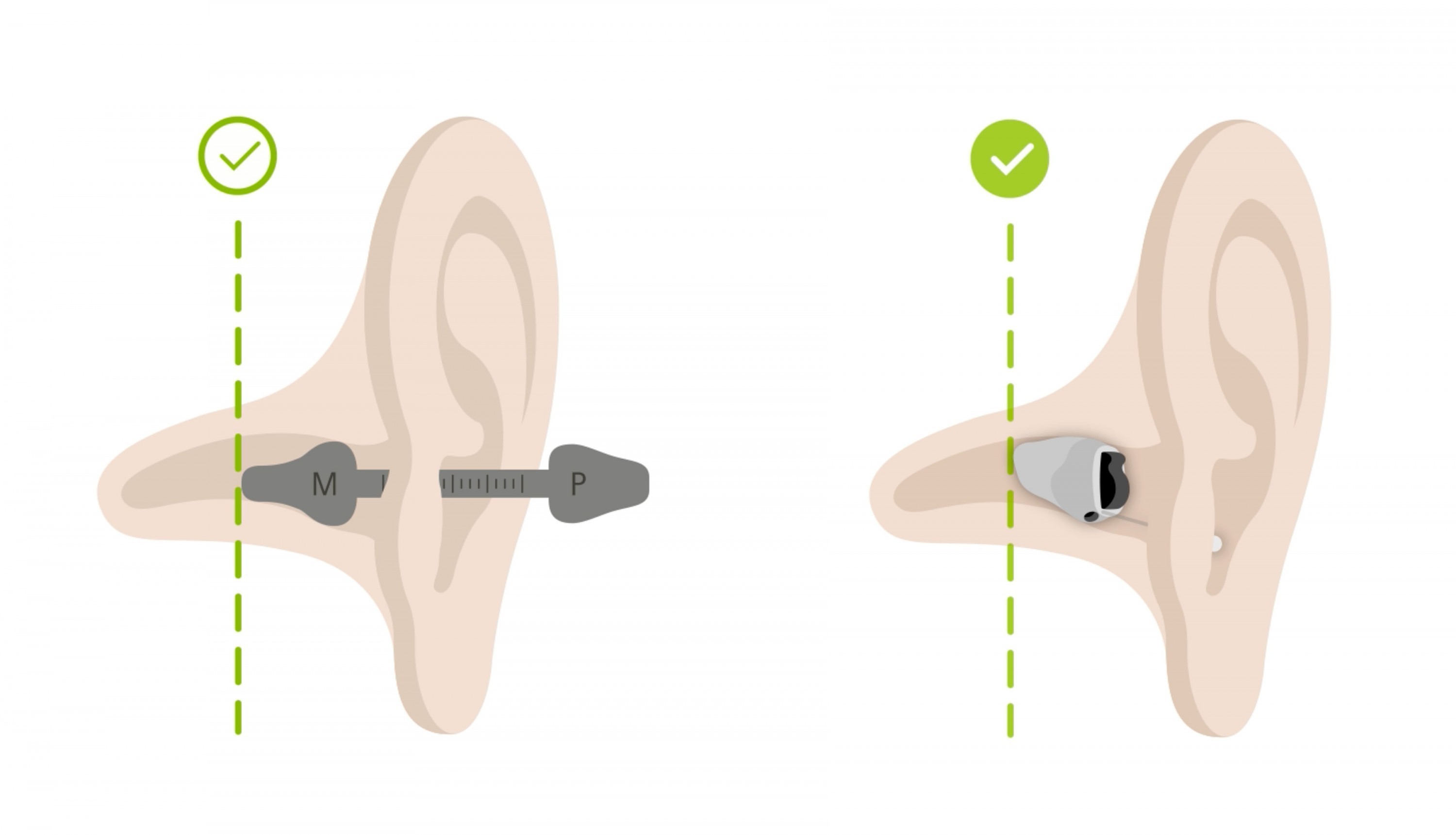 World's Best & Smallest Hearing Aids 2024 Hearing Aid UK