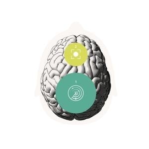 Oticon Brain Hearing Technology